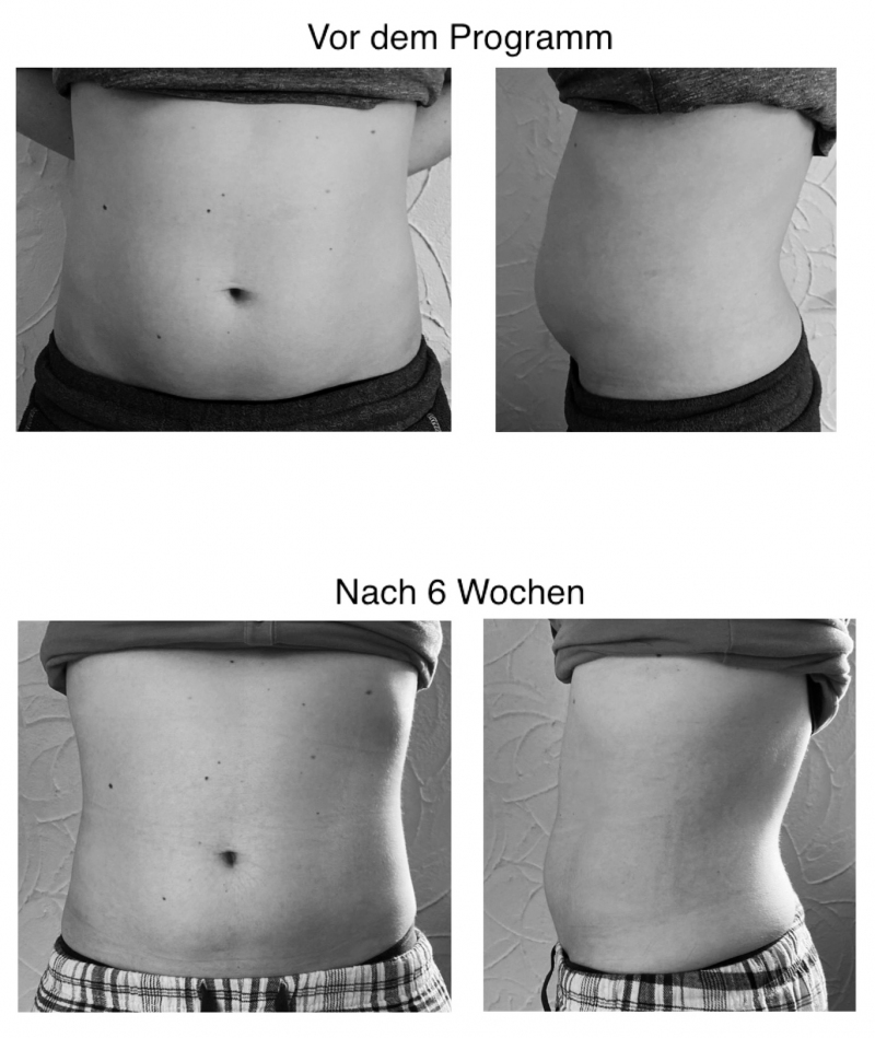 Tupler Tecnique - vorher/nachher